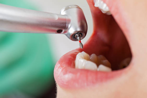 Best Pediatric Emergency Dentist in Judson, SC